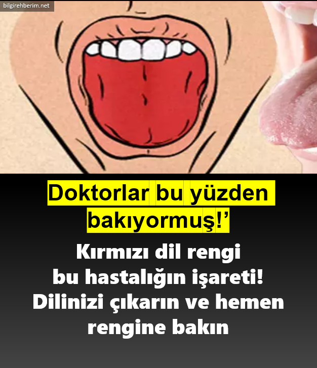 Kırmızı dil rengi bu hastalığın işareti Bilgi Rehberim