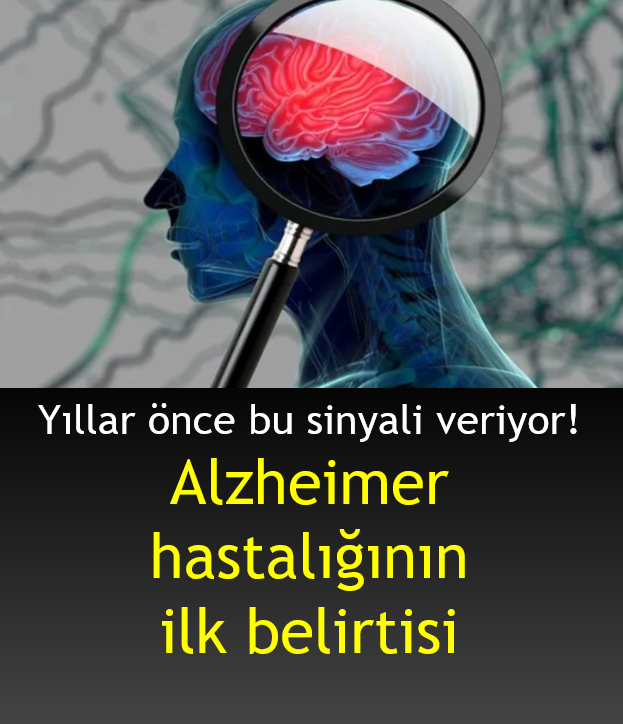 Alzheimer Hastalığının Ilk Belirtisi - Bilgi Rehberim