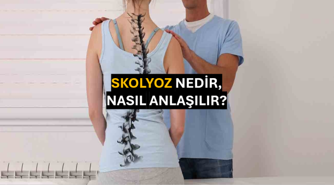 Skolyoz Nedir, Nasıl Anlaşılır?