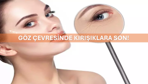 Göz Çevresinde Kırışıklara Son!